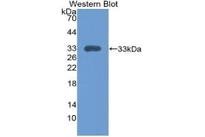 Western blot analysis of the recombinant protein. (Integrin alpha 1 抗体  (AA 103-368))