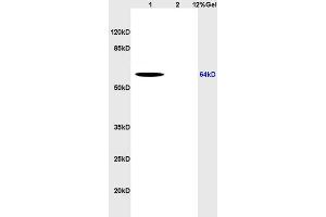 Lane 1: human colon carcinoma lysates Lane 2: rat brain lysates probed with Anti CD166 Polyclonal Antibody, Unconjugated (ABIN673944) at 1:200 in 4 °C. (CD166 抗体  (AA 451-583))