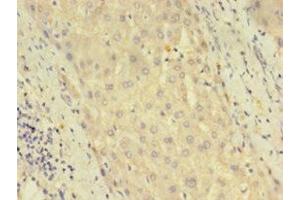 Immunohistochemistry of paraffin-embedded human liver tissue using ABIN7150765 at dilution of 1:100 (DUSP26 抗体  (AA 1-211))