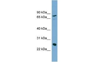 WB Suggested Anti-KLK5 Antibody Titration:  0. (Kallikrein 5 抗体  (N-Term))