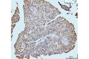 IHC analysis of Neurofibromin/NF1 using anti-Neurofibromin/NF1 antibody (ABIN7600197). (Neurofibromin 1 抗体  (AA 160-270))