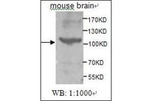 Western Blotting (WB) image for anti-tyrosine Kinase, Non-Receptor, 2 (TNK2) (AA 278-289) antibody (ABIN955283) (TNK2 抗体  (AA 278-289))