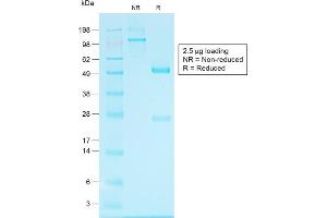 SDS-PAGE Analysis of Purified Glypican-3 Rabbit Recombinant Monoclonal Antibody (GPC3/1534R). (Glypican 3 抗体)