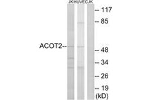 Western Blotting (WB) image for anti-Acyl-CoA Thioesterase 2 (ACOT2) (AA 171-220) antibody (ABIN2890093) (ACOT2 抗体  (AA 171-220))