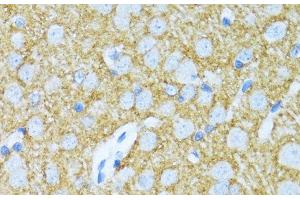 Immunohistochemistry of paraffin-embedded Rat brain using SYP Polyclonal Antibody at dilution of 1:100 (40x lens). (Synaptophysin 抗体)