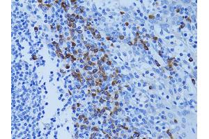 Immunohistochemistry of paraffin-embedded human tonsil using ATG7 antibody (ABIN5970265) at dilution of 1/100 (40x lens). (ATG7 抗体)