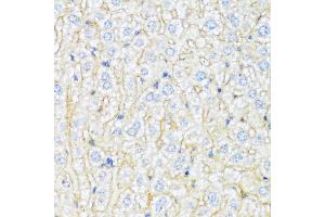 Immunohistochemistry of paraffin-embedded mouse liver using ABCA6 antibody (ABIN1870712) at dilution of 1:100 (40x lens). (ABCA6 抗体)