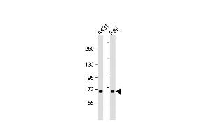 All lanes : Anti-P3K5 Antibody  at 1:2000 dilution Lane 1: A431 whole cell lysate Lane 2: Raji whole cell lysate Lysates/proteins at 20 μg per lane. (ASK1 抗体  (AA 821-849))