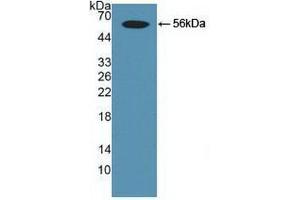 Western blot analysis of recombinant Human Smad9. (SMAD9 抗体  (AA 226-459))