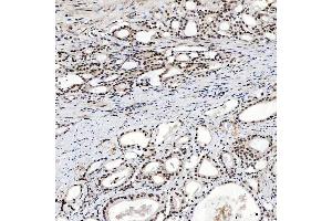 IHC analysis of SNRNP200 using anti-SNRNP200 antibody (ABIN7602032). (SNRNP200 抗体  (AA 557-2129))