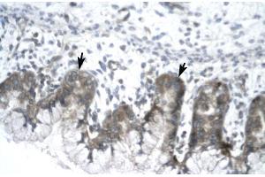 Human Stomach; IVNS1ABP antibody - N-terminal region in Human Stomach cells using Immunohistochemistry (IVNS1ABP 抗体  (N-Term))