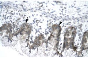 Human Stomach; IVNS1ABP antibody - N-terminal region in Human Stomach cells using Immunohistochemistry
