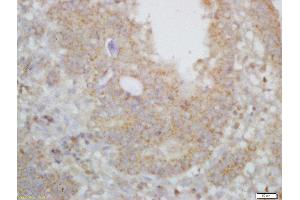 Immunohistochemistry (Paraffin-embedded Sections) (IHC (p)) image for anti-Actin Related Protein 2/3 Complex, Subunit 2, 34kDa (ARPC2) (AA 201-300) antibody (ABIN1714662)