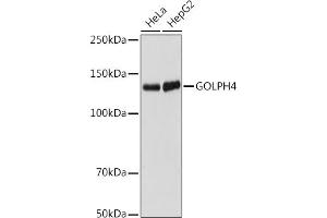 Western blot analysis of extracts of various cell lines, using GOLPH4 antibody (ABIN7267488) at 1:1000 dilution. (Golgi Integral Membrane Protein 4 (GOLIM4) 抗体)