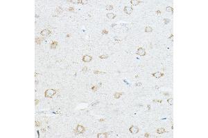 Immunohistochemistry of paraffin-embedded rat brain using IL1RAP Rabbit pAb (ABIN6128127, ABIN6142347, ABIN6142348 and ABIN6220984) at dilution of 1:100 (40x lens). (IL1RAP 抗体  (AA 21-356))