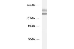 dilution: 1 : 1000, sample: mouse brain homogenate (Tenascin R 抗体)