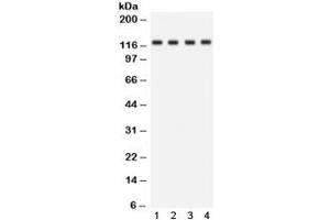 Western blot testing of human 1) HeLa, 2) Jurkat, 3) SKOV and 4) mouse kidney lysate with SLC12A1 antibody. (SLC12A1 抗体)