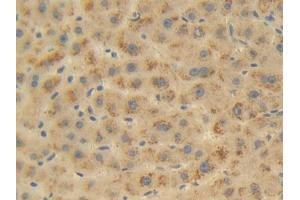 Used in DAB staining on fromalin fixed paraffin-embedded Liver tissue (FKBP1B 抗体  (AA 2-108))