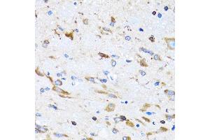 Immunohistochemistry of paraffin-embedded mouse spinal cord using PTRH2 antibody (ABIN5973864) at dilution of 1/100 (40x lens). (PTRH2 抗体)
