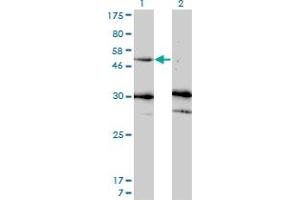 Western Blot analysis of MMP13 expression in transfected 293T cell line by MMP13 monoclonal antibody (M07), clone 3B11. (MMP13 抗体  (AA 362-471))