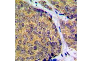 Immunohistochemistry (IHC) image for anti-Mitogen-Activated Protein Kinase Kinase 2 (MAP2K2) (C-Term), (pSer394) antibody (ABIN7299418)