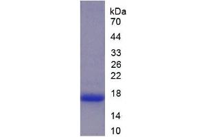 SDS-PAGE of Protein Standard from the Kit (Highly purified E. (Lactoferrin CLIA Kit)