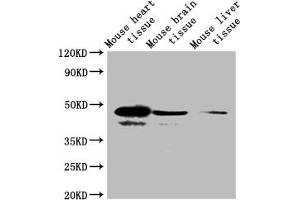 Western blot All lanes: Selenoprotein P antibody at 2 μg/mL + Mouse heart tissue Secondary Goat polyclonal to rabbit IgG at 1/10000 dilution Predicted band size: 43 kDa Observed band size: 43 kDa (Selenoprotein P (SELENOP) (AA 20-381) 抗体)
