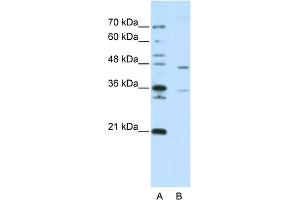 WB Suggested Anti-ZNF488 Antibody Titration:  2. (ZNF488 抗体  (C-Term))