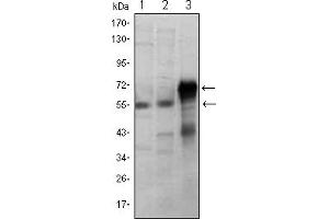 Western blot analysis using ETS1 mouse mAb against Jurkat (1), HepG2 (2) and ETS1-hIgGFc transfected HEK293 (3) cell lysate. (ETS1 抗体)