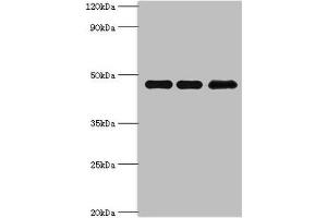 Western blot All lanes: Phosphatidylinositol 5-phosphate 4-kinase type-2 beta antibody at 10 μg/mL Lane 1: Hela whole cell lysate Lane 2: MCF-7 whole cell lysate Lane 3: 293T whole cell lysate Secondary Goat polyclonal to rabbit IgG at 1/10000 dilution Predicted band size: 48, 33 kDa Observed band size: 48 kDa (PIP4K2B 抗体  (AA 1-270))