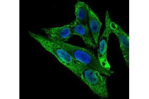 Immunofluorescence (IF) image for anti-rho GDP Dissociation Inhibitor (GDI) alpha (ARHGDIA) (AA 1-204) antibody (ABIN1844919)