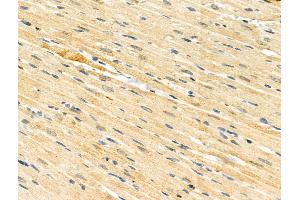 Phospho-HSF1 (Ser121) Antibody at 1/100 staining Rat heart tissue by IHC-P. (HSF1 抗体  (pSer121))