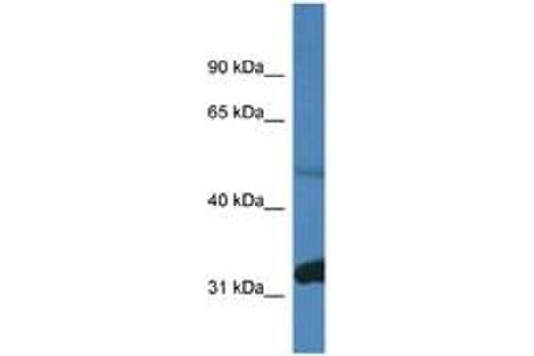 PPP2R2D Antikörper  (AA 380-429)