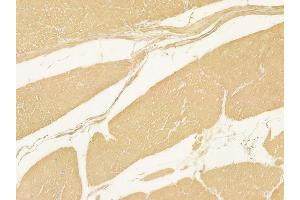ABIN6259562 and ABIN6275433 at 1/100 staining human normal gastric tissue by IHC-P.
