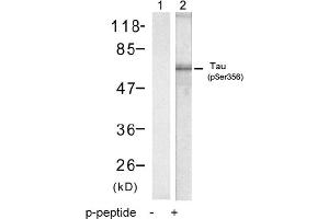 Image no. 1 for anti-Microtubule-Associated Protein tau (MAPT) (pSer356) antibody (ABIN319220) (MAPT 抗体  (pSer356))