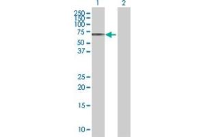 Western Blot analysis of MITF expression in transfected 293T cell line by MITF MaxPab polyclonal antibody. (MITF 抗体  (AA 1-520))