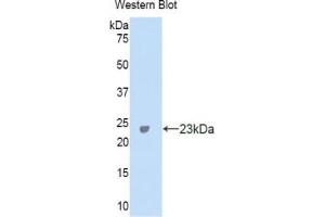 Western blot analysis of the recombinant protein. (CA5A 抗体  (AA 7-179))