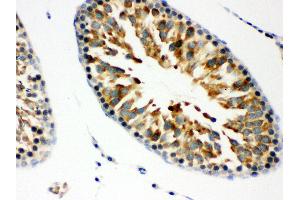 Immunohistochemistry (IHC) image for anti-COP9 Constitutive Photomorphogenic Homolog Subunit 5 (Arabidopsis) (COPS5) (AA 8-334) antibody (ABIN3042754)