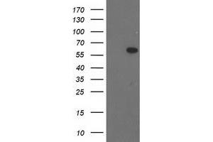 Western Blotting (WB) image for anti-BAI1-Associated Protein 2 (BAIAP2) antibody (ABIN1496807) (BAIAP2 抗体)