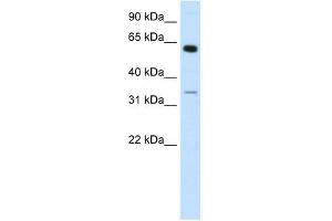 ZNF609 antibody (20R-1068) used at 0. (ZNF609 抗体  (N-Term))