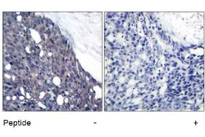 Image no. 1 for anti-Nuclear Factor of kappa Light Polypeptide Gene Enhancer in B-Cells Inhibitor, alpha (NFKBIA) (Tyr42) antibody (ABIN197391) (NFKBIA 抗体  (Tyr42))