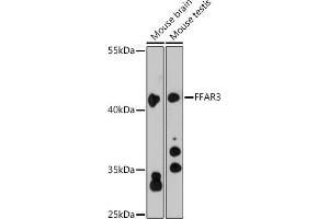 Western blot analysis of extracts of various cell lines, using FF antibody (ABIN6129724, ABIN6140586, ABIN6140587 and ABIN6216341) at 1:3000 dilution. (FFAR3 抗体  (AA 257-346))