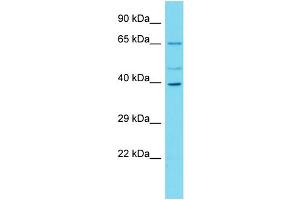 Western Blotting (WB) image for anti-Chromosome 16 Open Reading Frame 59 (C16ORF59) (N-Term) antibody (ABIN2791199) (C16ORF59 抗体  (N-Term))