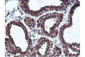 Immunohistochemical staining of paraffin-embedded Human breast tissue using anti-PSMB7 mouse monoclonal antibody. (PSMB7 抗体  (AA 58-277))