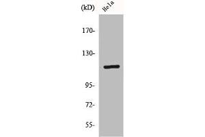 Western Blot analysis of HeLa cells using CARD 6 Polyclonal Antibody (CARD6 抗体  (N-Term))
