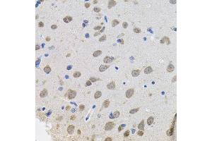 Immunohistochemistry of paraffin-embedded rat brain using VEPH1 antibody. (VEPH1 抗体  (AA 448-547))