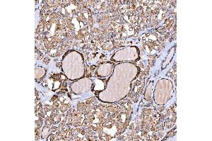IHC analysis of NLRX1 using anti-NLRX1 antibody (ABIN7602716).