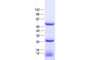 Western Blotting (WB) image for tRNA Methyltransferase 12 Homolog (TRMT12) protein (His tag) (ABIN2734347)