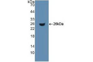 Detection of Recombinant ACO1, Human using Polyclonal Antibody to Aconitase 1 (ACO1) (Aconitase 1 抗体  (AA 26-243))