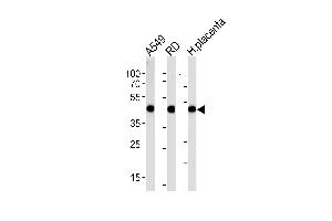 ACTA1/α-actin Antibody (C-term)  western blot analysis in A549,RD cell line and human placenta lysates (35 μg/lane). (Actin 抗体  (C-Term))